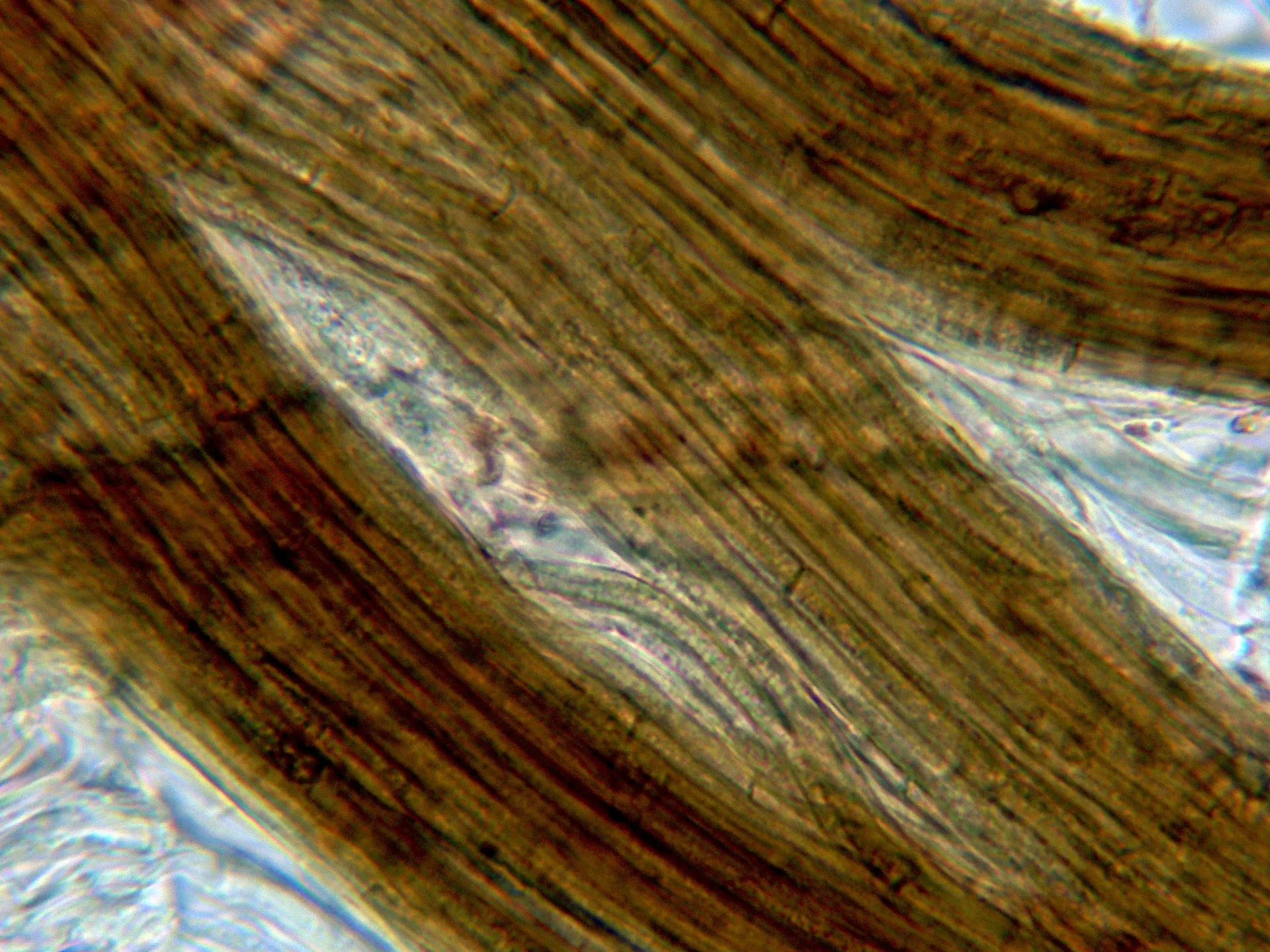 Microscopía de Gymnopus brassicolens - 10 - Hifas pie-001